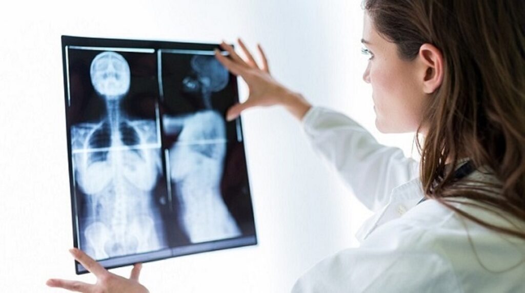 Nâng ngực có thể chụp X-quang hay không?