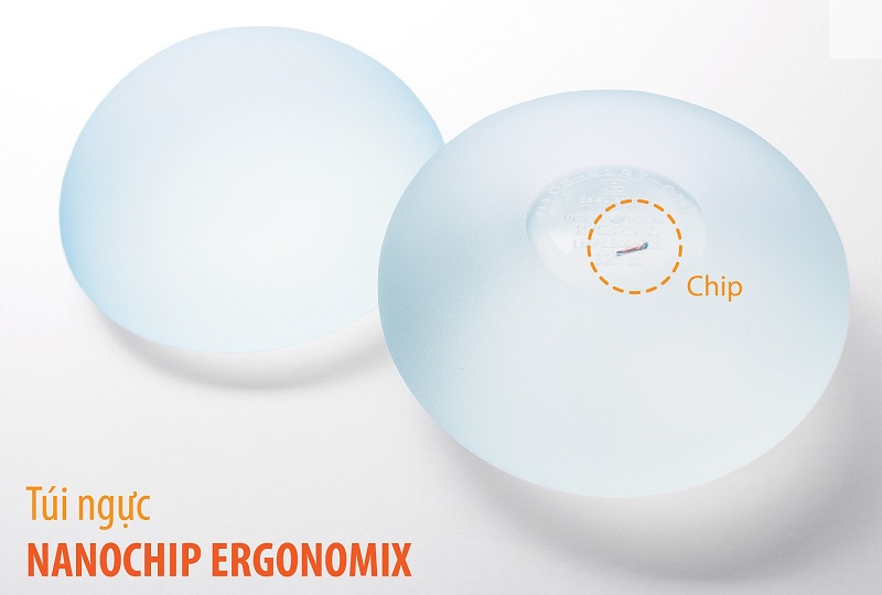 Nâng ngực bằng túi Nano Chip Ergonomix